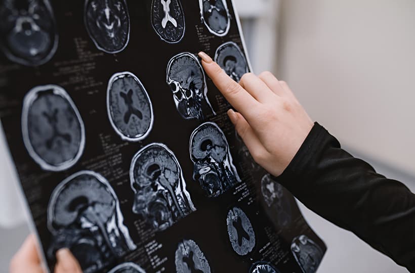 Neurology