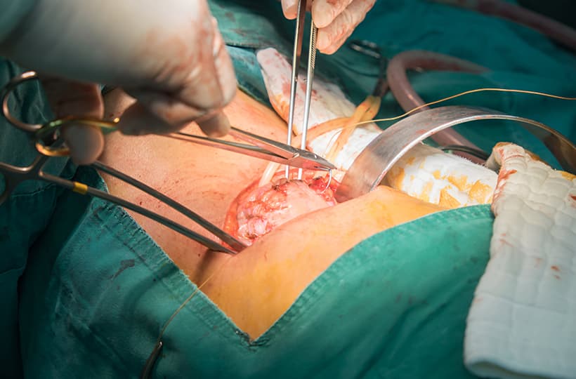 Urology