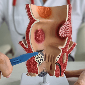 Proctology